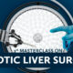Robotic liver surgery